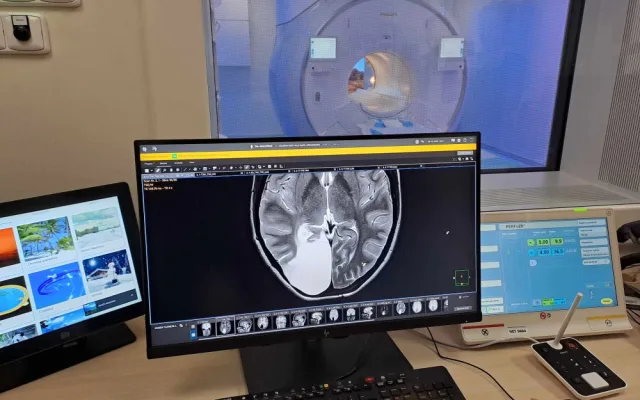 Nemocnice má novu magnetickou rezonanci s umělou inteligencí