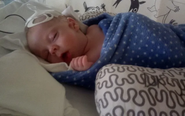 Dominik se narodil se třemi oušky a rozštěpem rtu, lékaři u něj objevili vzácné onemocnění