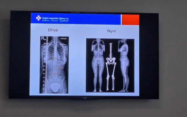 V Liberci vznikla laboratoř pohybové medicíny. Jako jediná v Česku kombinuje několik technologií
