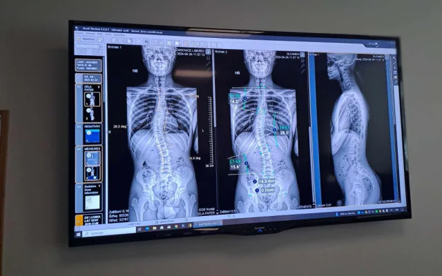 V Liberci vznikla laboratoř pohybové medicíny. Jako jediná v Česku kombinuje několik technologií