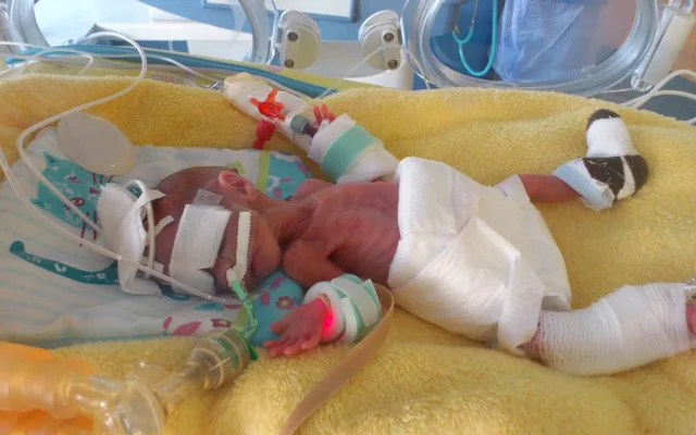 Když se narodili, vážili dohromady necelých 1200 gramů. Do života to Matějovi a Šimonovi přineslo řadu zdravotních problémů