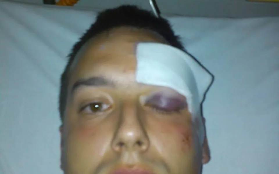 Sražený mladík krátce po nehodě