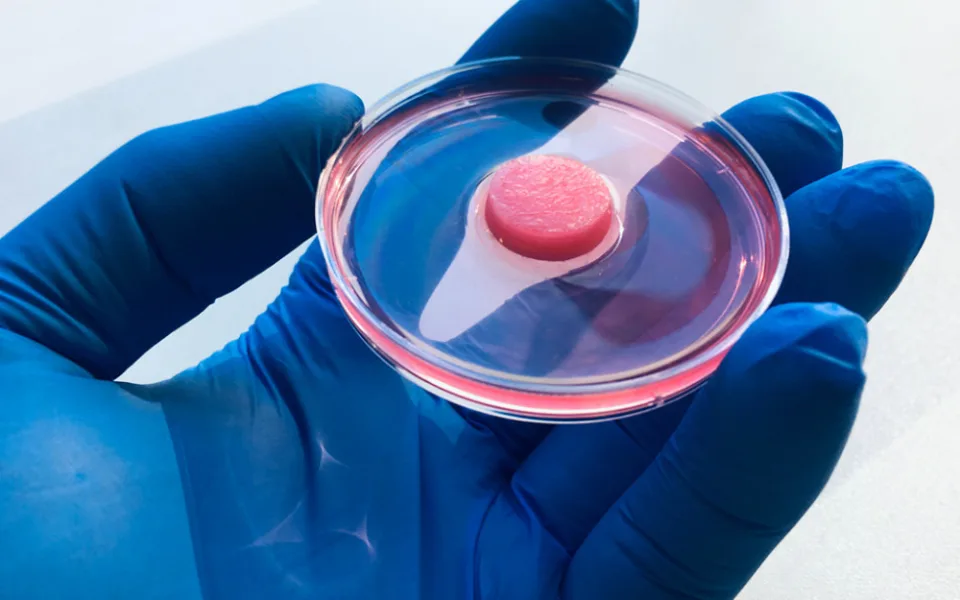 Organoid brzlíku.
