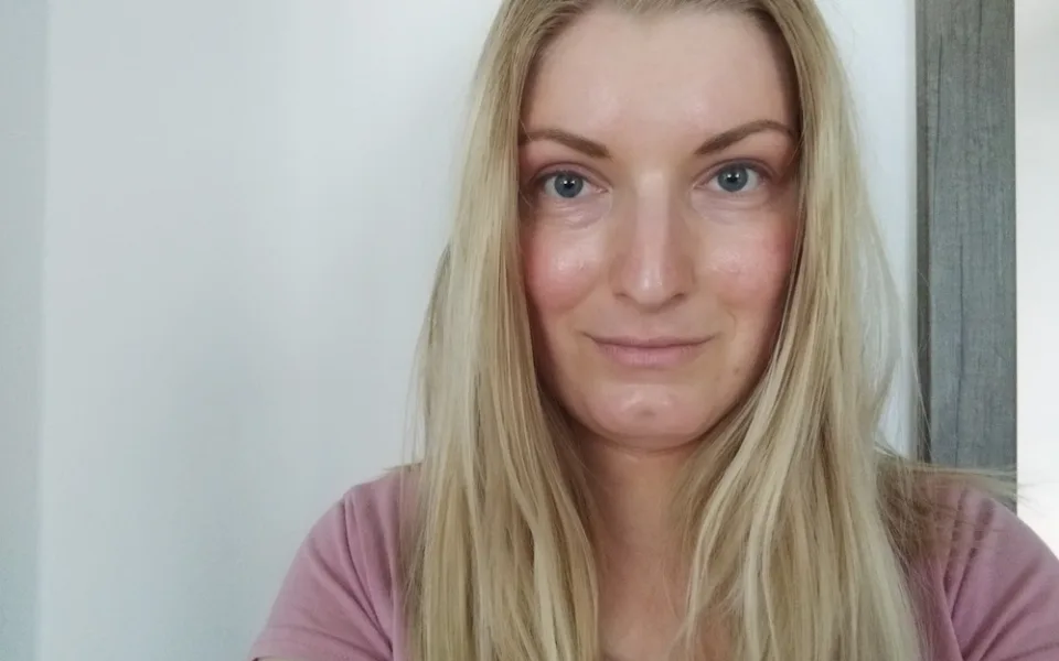 Atopický ekzém se mi objevuje téměř po celém těle. Nejhorší je stres, říká Veronika Seberová