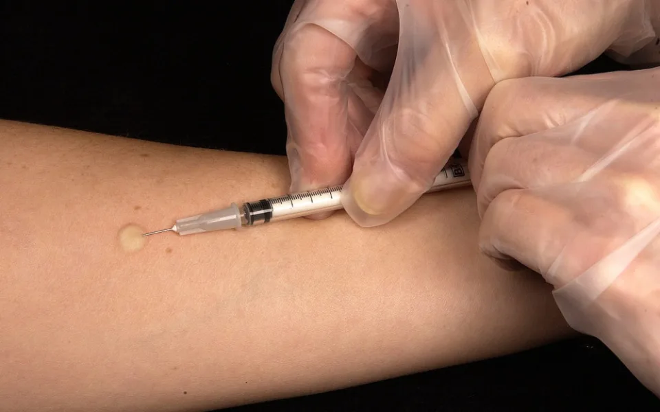 Na Jablonecku a Liberecku se šíří infekční žloutenka